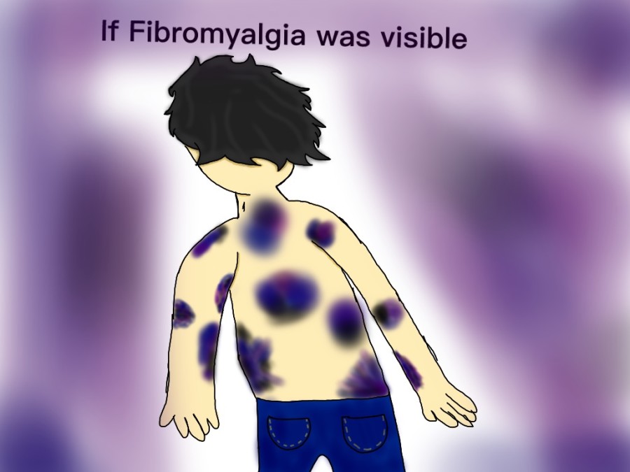 An illustration that shows what fibromyalgia would look like if it was visible.