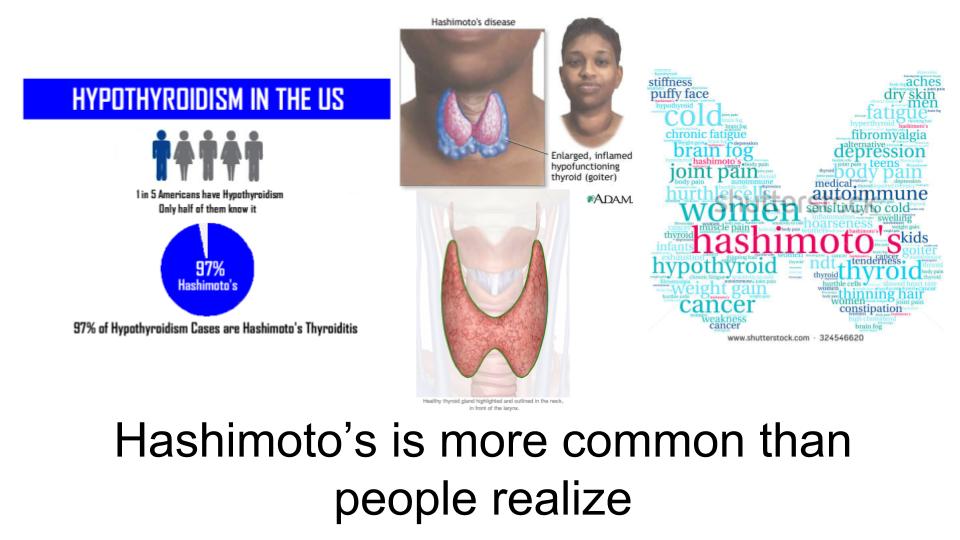 Hashimotos Infographic